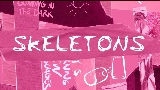 Мініатюра відео Skeletons